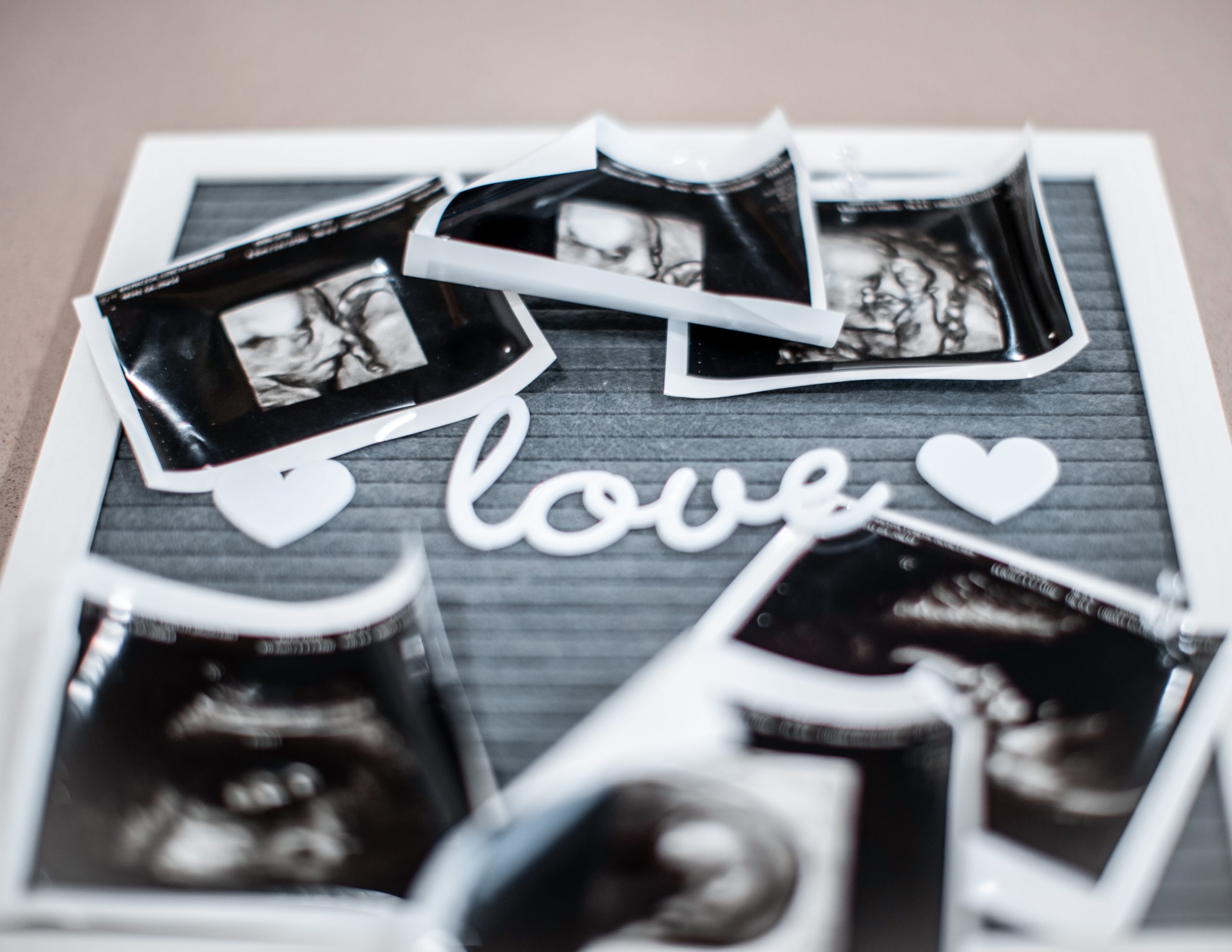 Six ultrasound pictures of a baby sitting on a letter board that says "love."